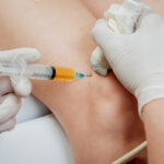 Ultrasound-guided platelet-rich plasma injection of the knee