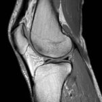 msk3