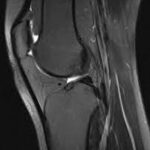 msk5