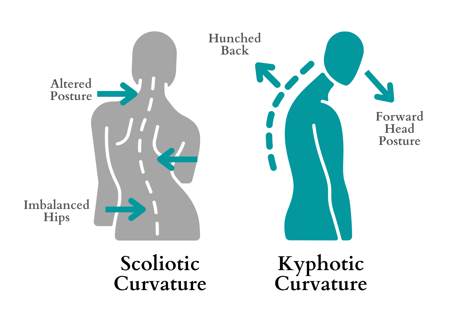 Spine Deformity Scolosis & Kyphosis